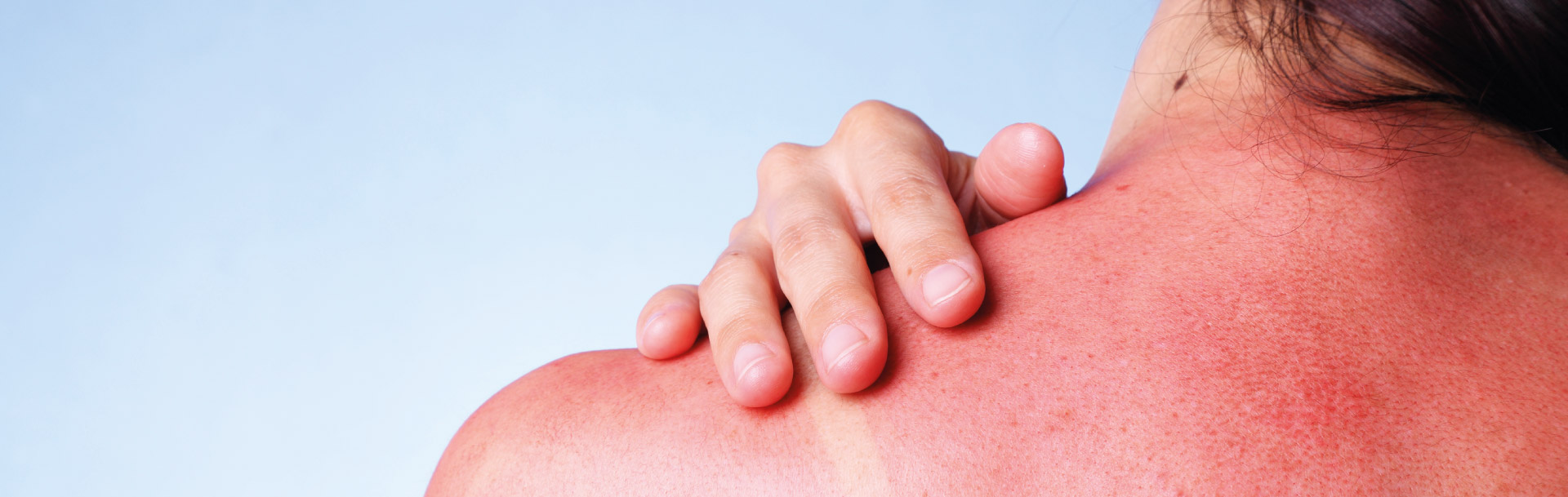 Geröteter Frauenrücken mit einer Hand aufegelegt