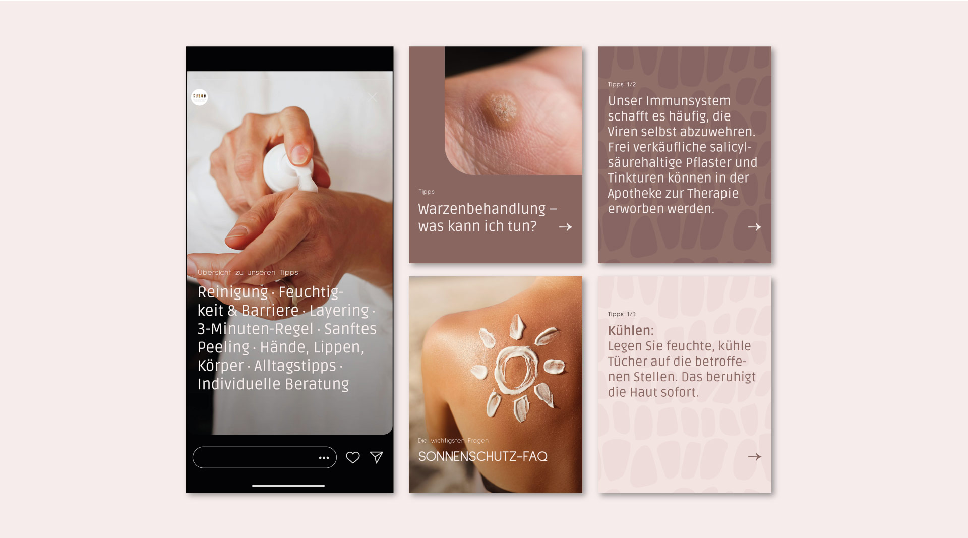 Abbildung von Social Media Posts und Stories von MVZ Die HautTypen